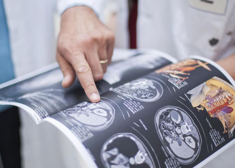Entorno clínico de Crystal Radiology con flujo de impresión DICOMJet