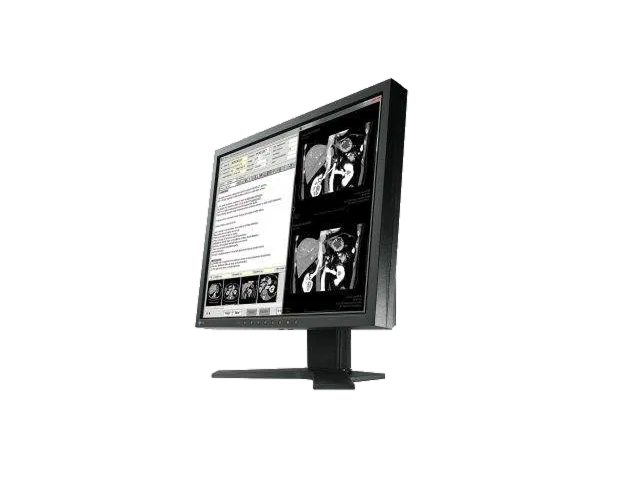 EIZO RadiForce MX194 — 19" 1.3MP Medical Monitor - Image 3