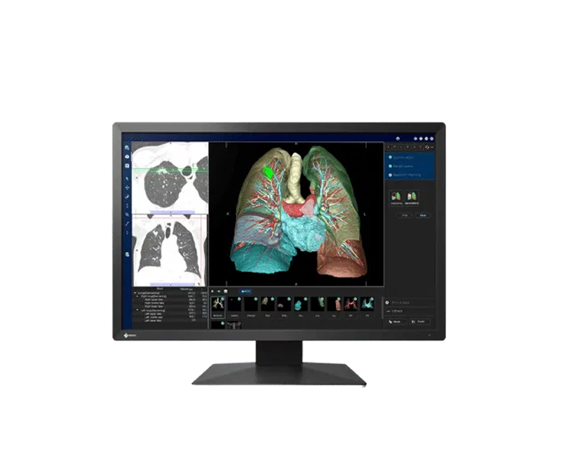 EIZO RadiForce MX243W — 24.1″ 2MP Widescreen Medical Monitor